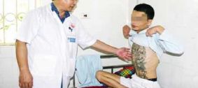 Làm thế nào để được cai nghiện ma túy tại nhà?